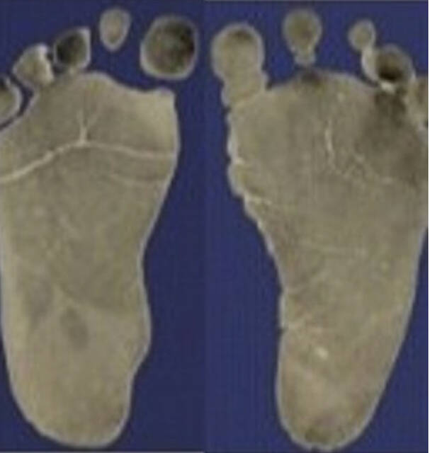 131904476_web1_babys-footprints-